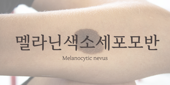 선천성 멜라닌색소 세포성모반 Melanocytic nevus